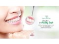 dentist-in-hamilton-small-2