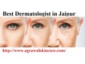 best-dermatologist-in-jaipur-small-0