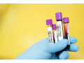 malaria-blood-test-in-delhi-at-low-price-small-0