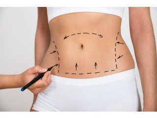 Discover Your Best Self: Liposuction Wonders in Delhi