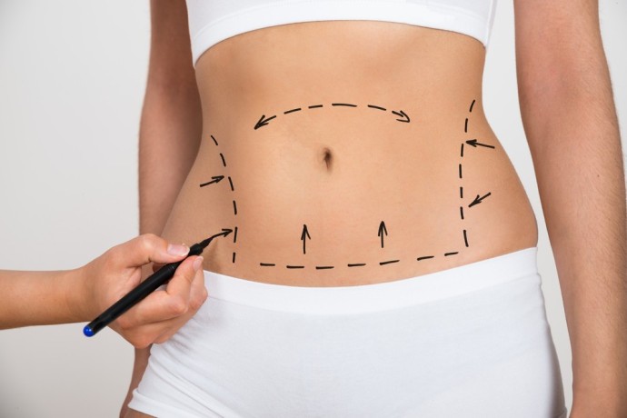 discover-your-best-self-liposuction-wonders-in-delhi-big-0