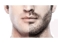 beard-transplant-packages-medlinks-india-pricing-small-0