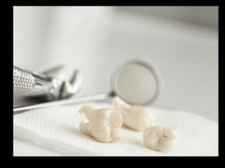 Wisdom Tooth Removal in Bistupur | Wisdom Tooth Removal Cost Bistupur