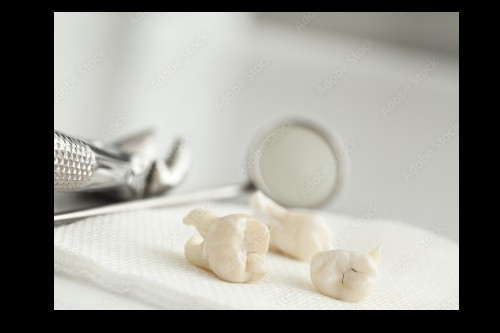 wisdom-tooth-removal-in-bistupur-wisdom-tooth-removal-cost-bistupur-big-0