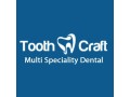 looking-for-affordable-invisible-braces-in-chennai-small-0