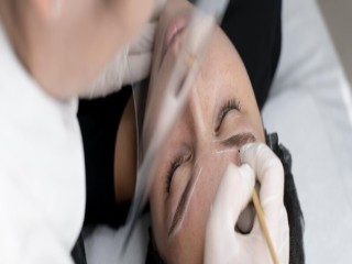 Perfect Eyebrow Hair Transplant in Delhi | Regain Your Confidence