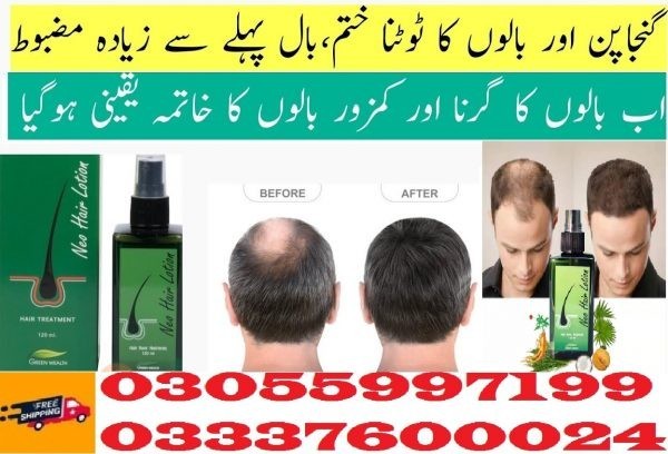 neo-hair-lotion-price-in-kasur-03055997199-big-0