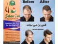 sahara-care-regrowth-hair-oil-in-pakistan-03001819306-small-0