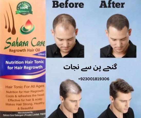 sahara-care-regrowth-hair-oil-in-pakistan-03001819306-big-0