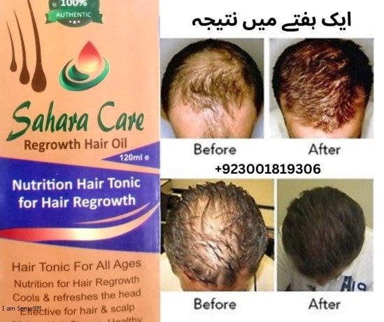 sahara-care-regrowth-hair-oil-in-pakistan-03001819306-big-0