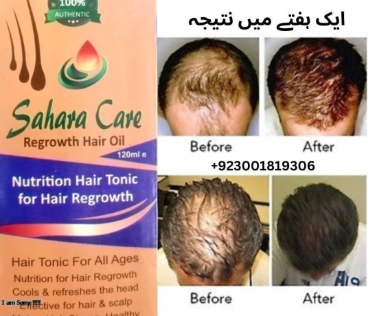 sahara-care-regrowth-hair-oil-in-bahawalpur-03001819306-big-0