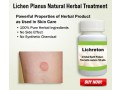 buy-herbal-products-for-lichen-planus-small-0