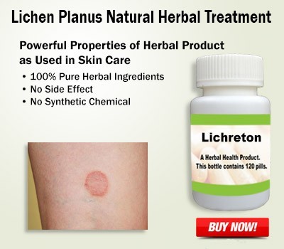 buy-herbal-products-for-lichen-planus-big-0