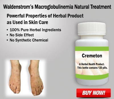 buy-herbal-product-for-waldenstroms-macroglobulinemia-big-0