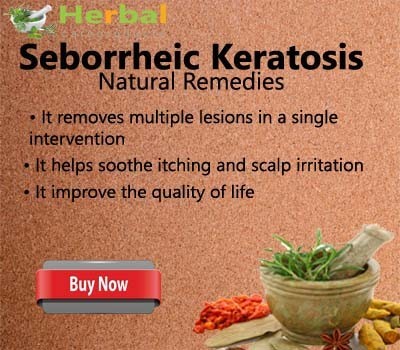 herbal-supplement-for-seborrheic-keratosis-big-0