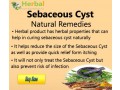 herbal-product-for-sebaceous-cyst-small-0