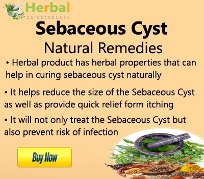 herbal-product-for-sebaceous-cyst-big-0