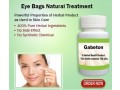 natural-treatment-for-eye-bags-small-0