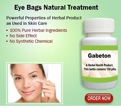 natural-treatment-for-eye-bags-big-0