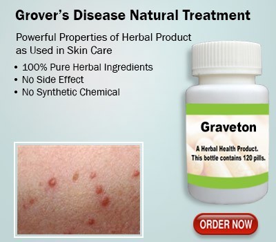 grovers-disease-with-herbal-supplement-big-0