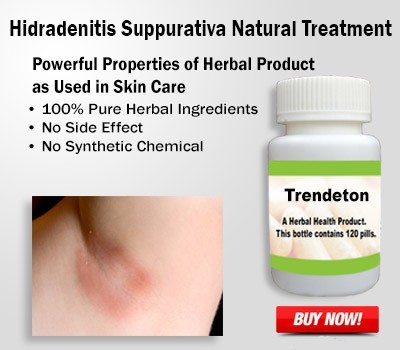 natural-remedies-for-hidradenitis-suppurativa-big-0