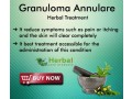 herbal-products-for-granuloma-annulare-small-0