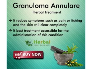 Herbal Products for Granuloma Annulare