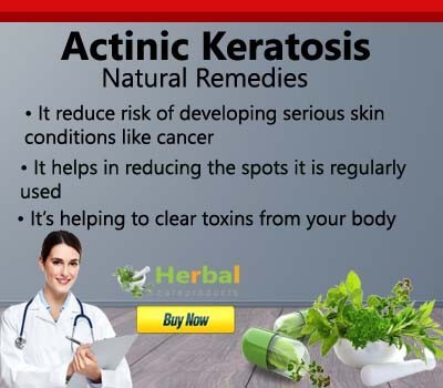 herbal-supplement-for-actinic-keratosis-big-0