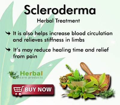 herbal-treatment-for-scleroderma-big-0