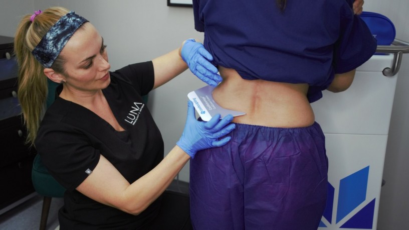 coolsculpting-specialists-in-hudson-valley-luna-dermatology-big-0