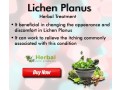 natural-supplement-for-lichen-planus-small-0