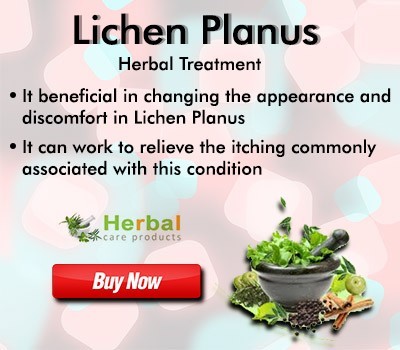 natural-supplement-for-lichen-planus-big-0