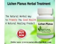 natural-remedies-for-lichen-planus-small-0