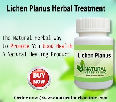 natural-remedies-for-lichen-planus-big-0