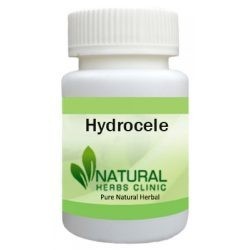 herbal-supplement-for-hydrocele-big-0