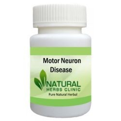 natural-remedies-for-motor-neuron-diseases-big-0