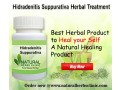 natural-remedies-for-hidradenitis-suppurativa-small-0