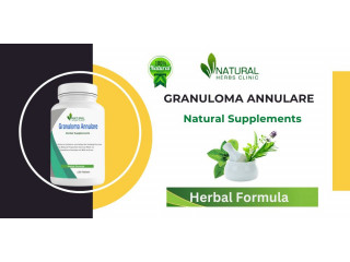 Best Herbal Supplements for Granuloma Annulare Natural Cure