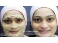 permanent-skin-lightening-skin-whitening-products-27738432716-small-2
