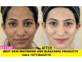 permanent-skin-lightening-skin-whitening-products-27738432716-small-0