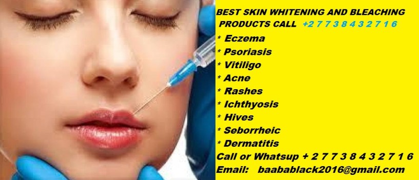 permanent-skin-lightening-skin-whitening-products-27738432716-big-1