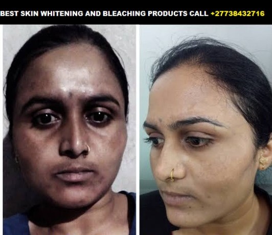permanent-skin-lightening-skin-whitening-products-27738432716-big-3