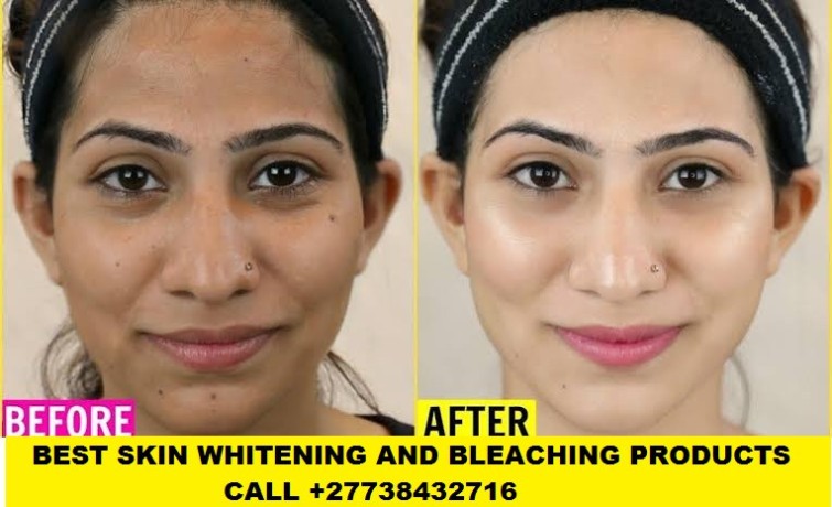 permanent-skin-lightening-skin-whitening-products-27738432716-big-0