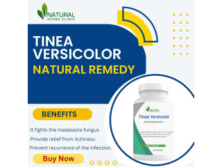 Safe and Effective Tinea Versicolor Natural Remedies