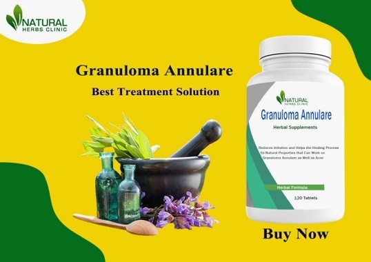 supplements-for-granuloma-annulare-manufactured-by-natural-herbs-clinic-big-0