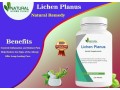 lichen-planus-treatment-home-remedy-by-natural-herbs-clinic-small-0