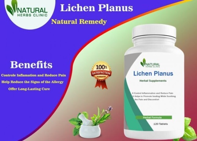 lichen-planus-treatment-home-remedy-by-natural-herbs-clinic-big-0