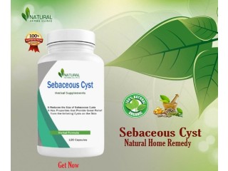 Sebaceous Cyst Home Remedy by Natural Herbs Clinic