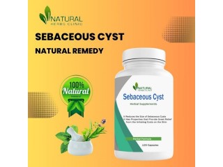 Home Removal of Sebaceous Cyst Solution