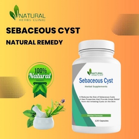 home-removal-of-sebaceous-cyst-solution-big-0